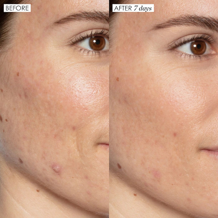 Good Genes All-In-One AHA Lactic Acid Treatment | Sephora (US)