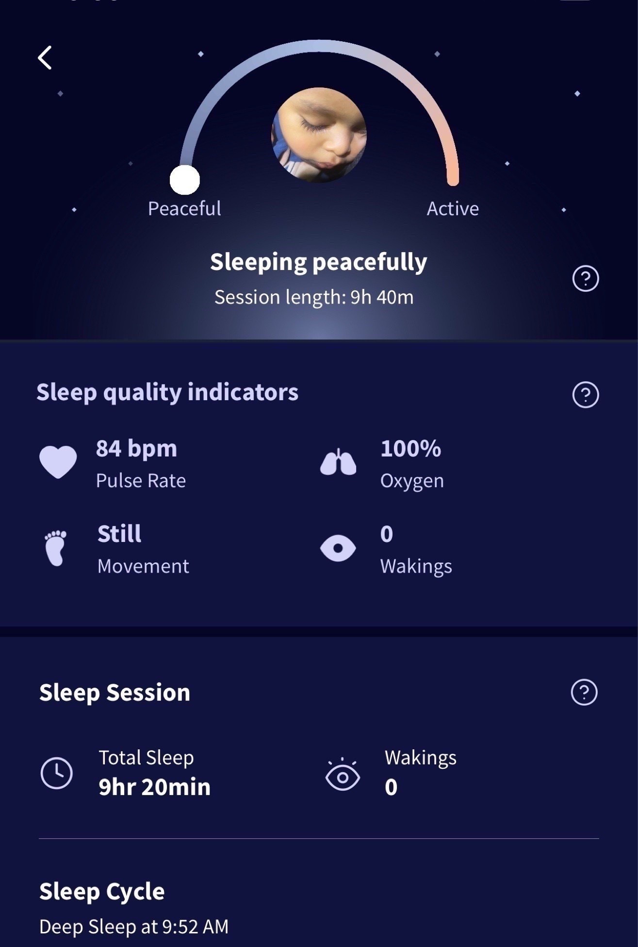 Secretsofyve: Look at Raizo’s stats! the @Owlet Dream Sock is now FDA cleared & the first and only over-the-counter medical pulse-oximetry device for infants! This monitoring system has brought Iggy and I such a piece of mind with baby Raizo. It is a fantastic gift for new parents & parents-to-be. Remember that you can use your HSA/FSA funds to purchase the Smart Sock and Smart Sock Plus. #Owletpartner .AD
* This new FDA clearance will allow Dream Sock users to track their infant’s Live Health Readings, including pulse rate and oxygen saturation level.
* The clearance includes Owlet’s new Health Notifications, which will alert parents with lights and alarm sounds if their baby’s health readings fall outside of preset ranges.
* Achieving De Novo clearance means the Owlet Dream Sock was clinically-tested in both home and hospital environments, and proven to be as accurate as medical-grade baby monitoring technology.
* Intended for use with healthy infants between 1-18 months and 6-30 lbs.
#Secretsofyve #LTKfind #ltkgiftguide
Always humbled & thankful to have you here.. 
CEO: PATESI Global & PATESIfoundation.org
DM me on IG with any questions or leave a comment on any of my posts. #ltkwatchnow #ltkhome @secretsofyve : where beautiful meets practical, comfy meets style, affordable meets glam with a splash of splurge every now and then. I do LOVE a good sale and combining codes! @target @bestbuy #ltkholiday #ltkcyberweek #ltkstyletip #ltksalealert #ltkkids #ltkfamily #ltkholiday #ltkmomlife secretsofyve

#LTKBump #LTKSeasonal #LTKBaby