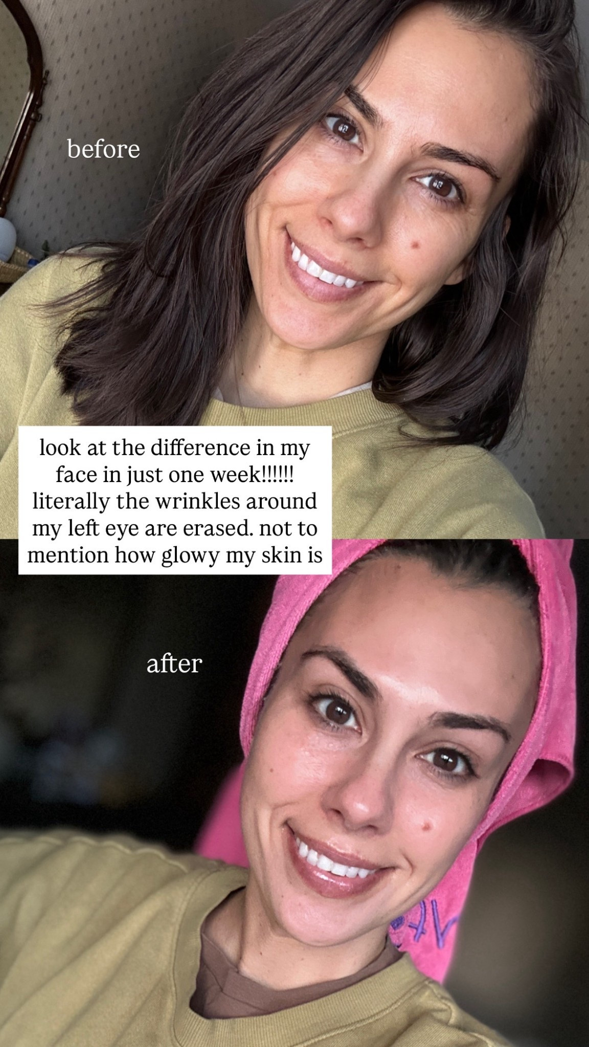 Forget chemical peels or microneedle treatments, all you need this this mask

#LTKmorningroutine #LTKselfcare #LTKBeauty