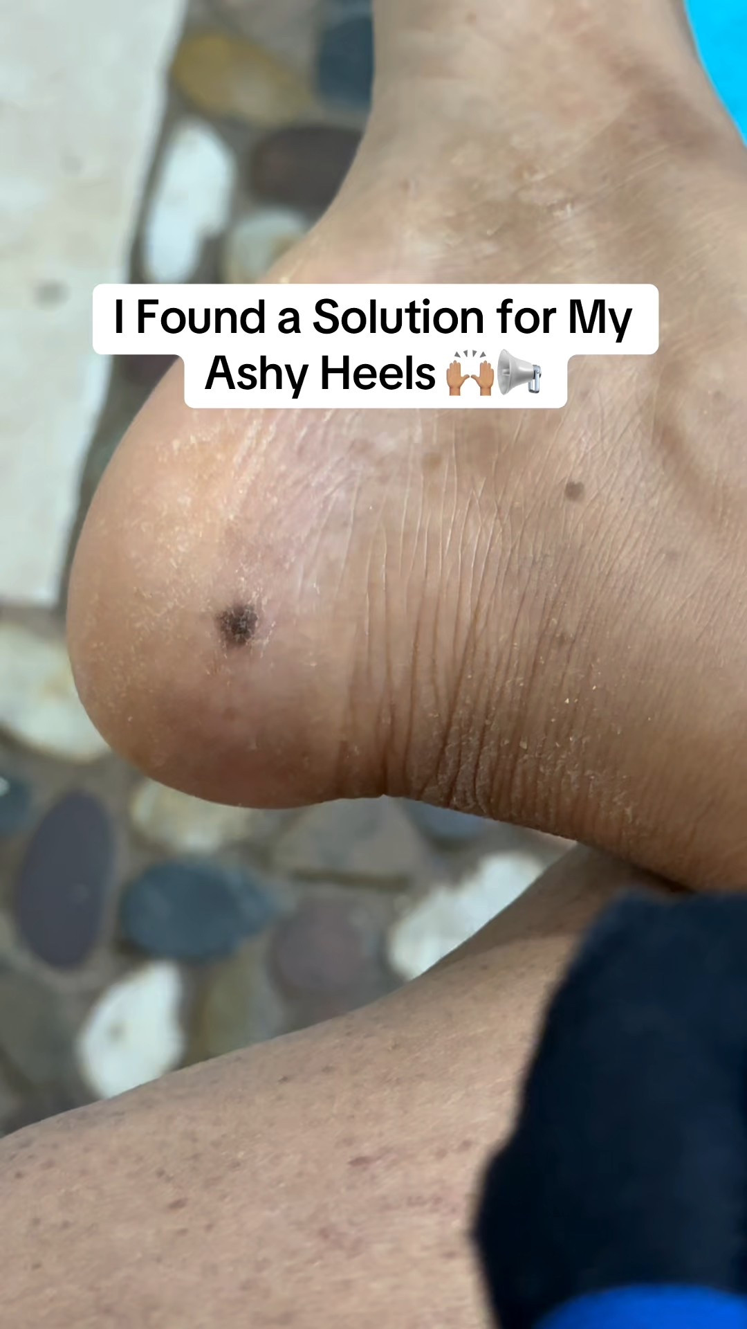 #tallow #beeftallow #skincaregoals 

#LTKOver40 #LTKFindsUnder50