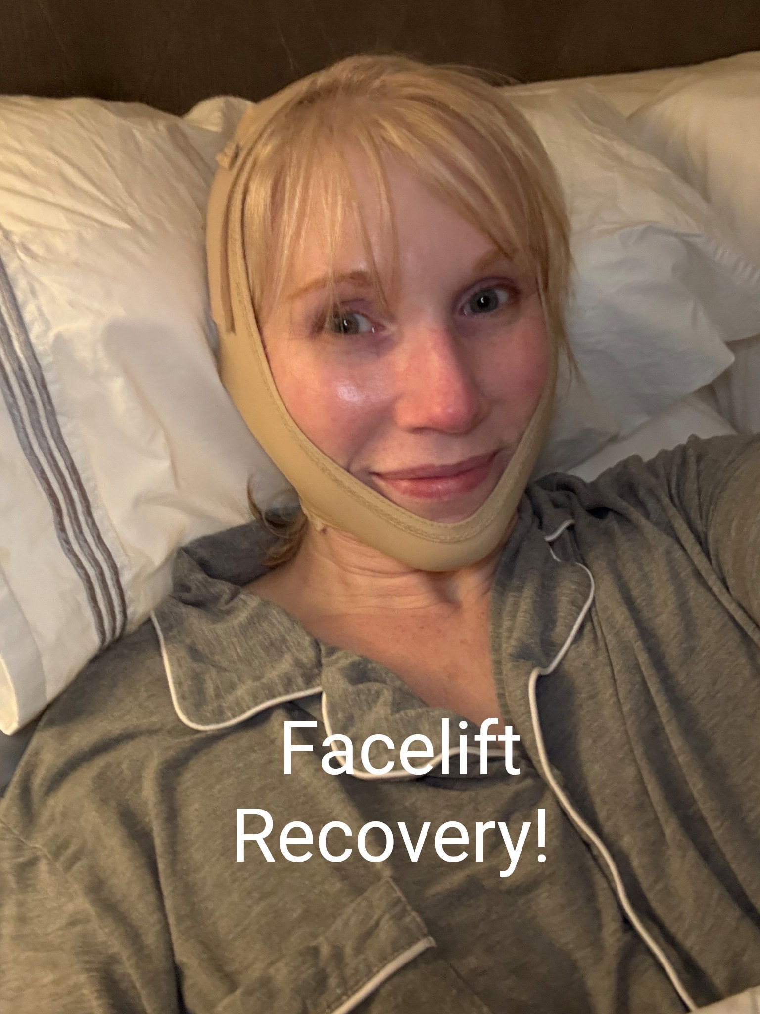 I am recovering after my lower facelift and Necklift. Here are the items that are helping me! 

#LTKBeauty #LTKOver40 #LTKMidsize
