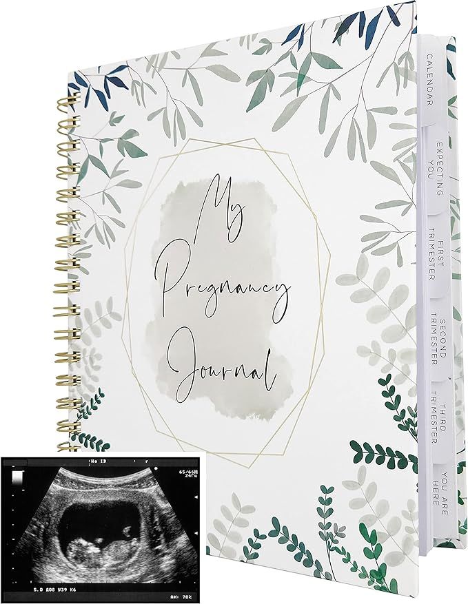 Pregnancy Journal Memory Book for Expecting Moms - Calendar for Pregnancy Planner - Weekly Monthl... | Amazon (US)