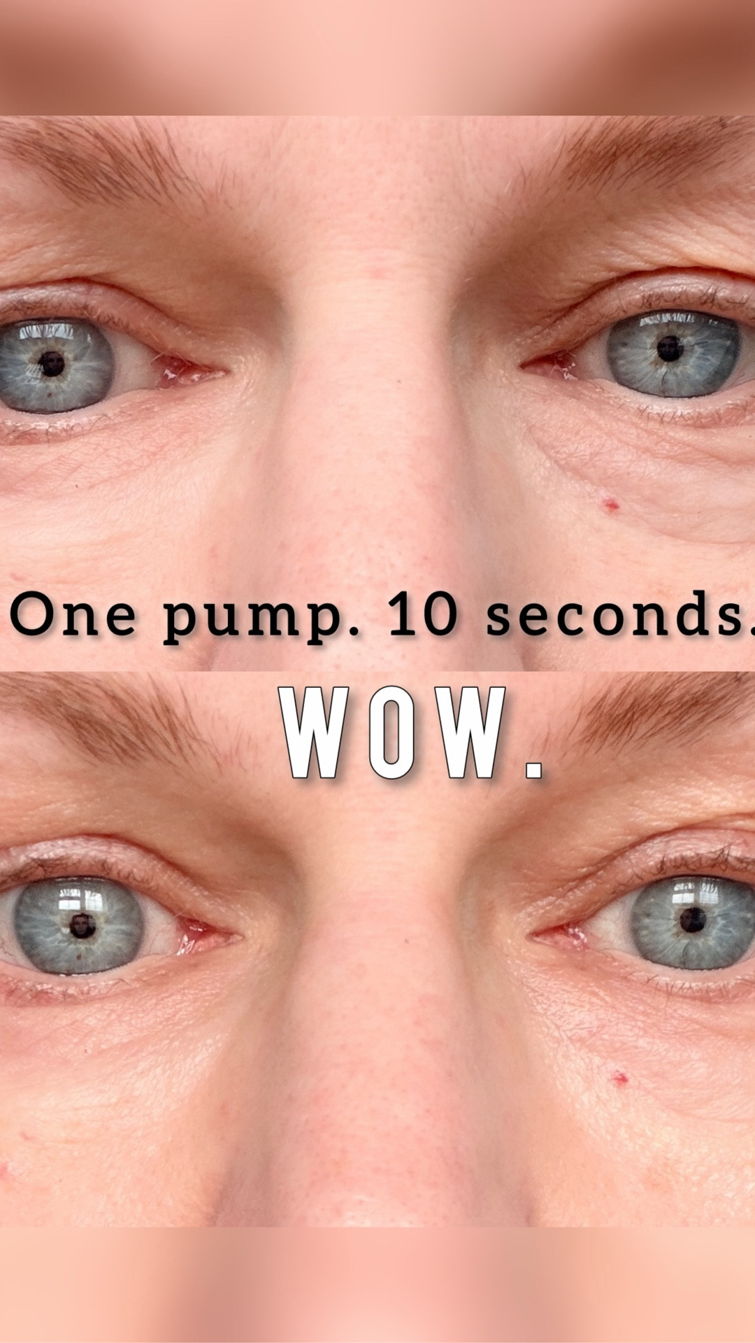 A visible lift in seconds, a real transformation over time. That’s Md Aire’s kind of magic.

Eyes and lips—two places that show everything.
Md Aire’s Eye Complex lifted my tired eyes, and their Peptide Lip Mask? Like satin in a jar.
Clean, clinical, and luxuriously simple. 

I am always up for trying new products that will help my eyes. This one gets my applause. 



#LTKBeauty #LTKmorningroutine #LTKOver40