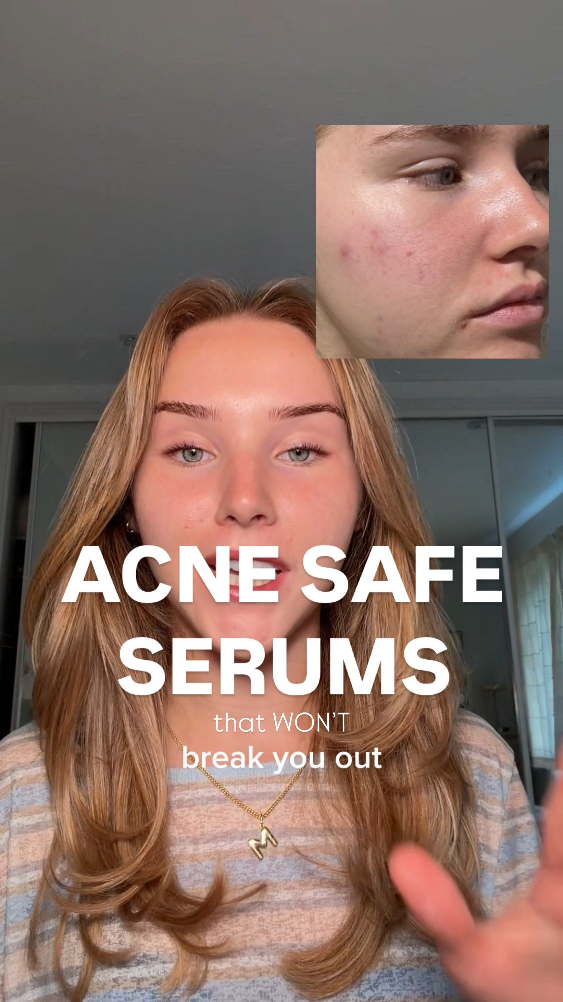 Acne safe serums!! Use code LIFEWITHMILS at checkout for discount on everything linked💓💓