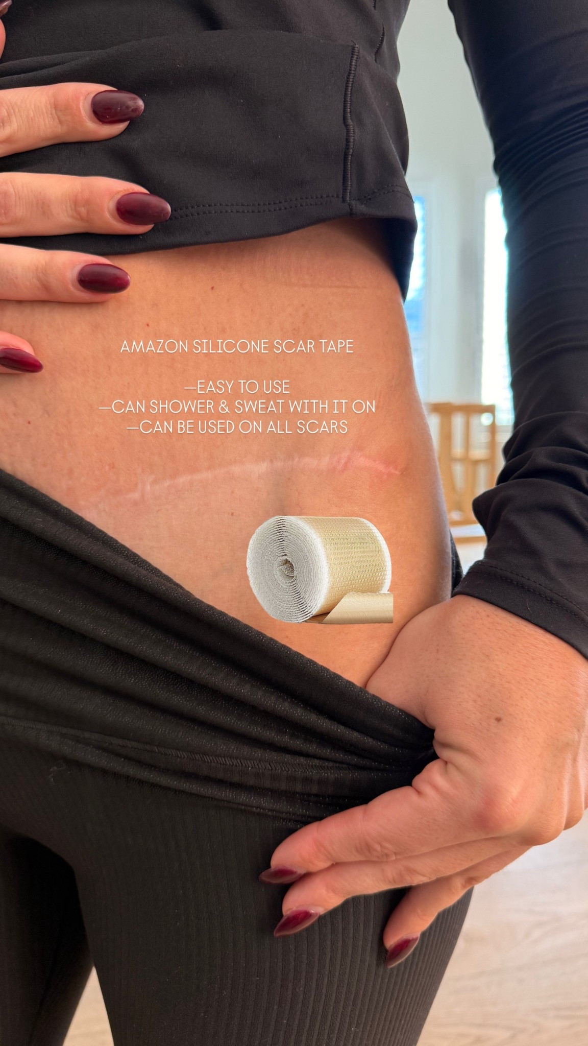 Amazon silicone scar tape // great for all scars and even facial wrinkles. 

Surgery recovery 
Skincare 


#LTKselfcare #LTKdayinmylife #LTKFindsUnder50