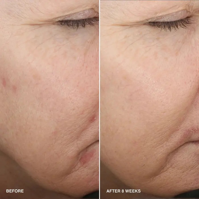 Vitamin Enriched Smoothing Serum with Niacinamide | Nordstrom