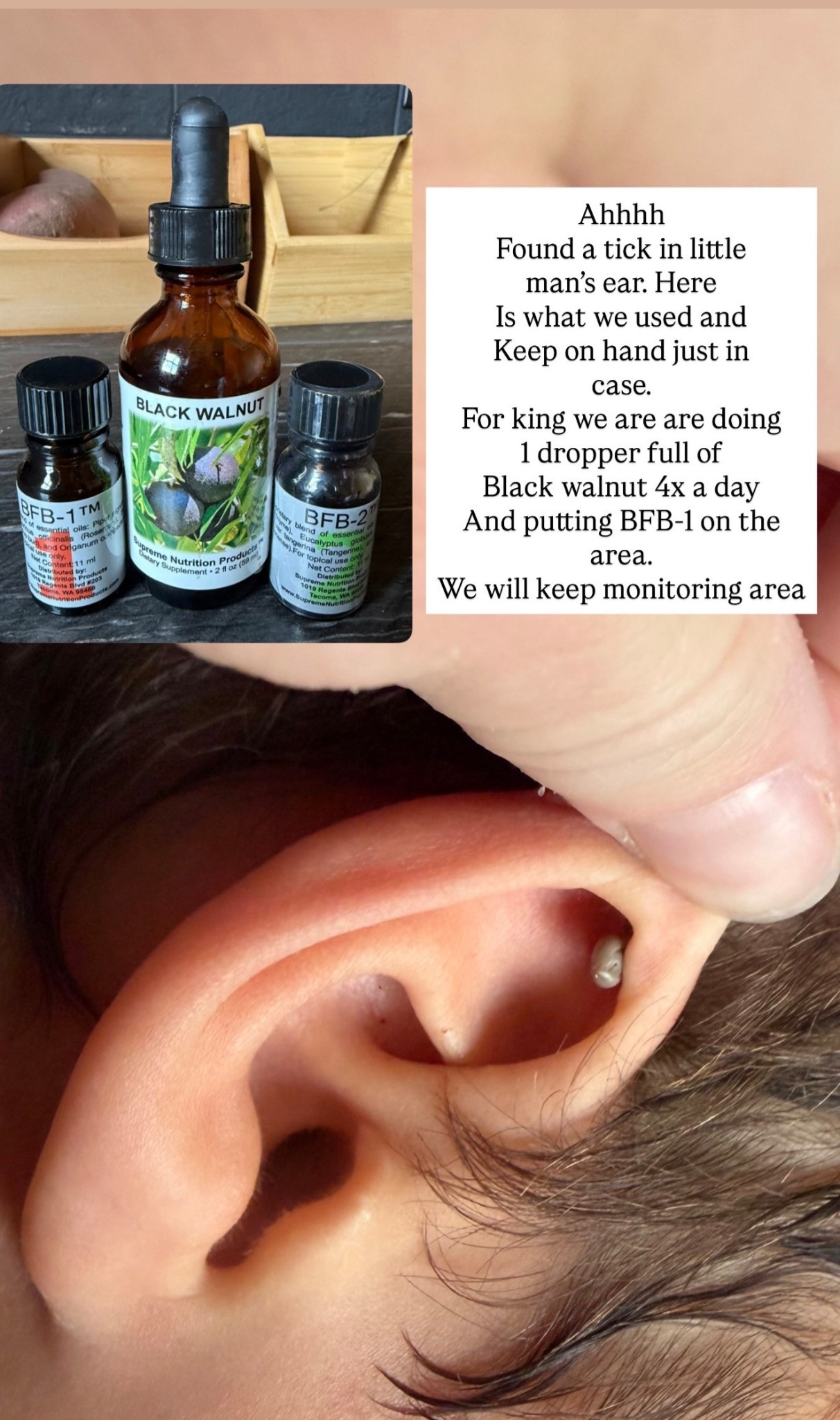 Here is what we used for little man’s tick  

#LTKKids #LTKSeasonal #LTKmomlife