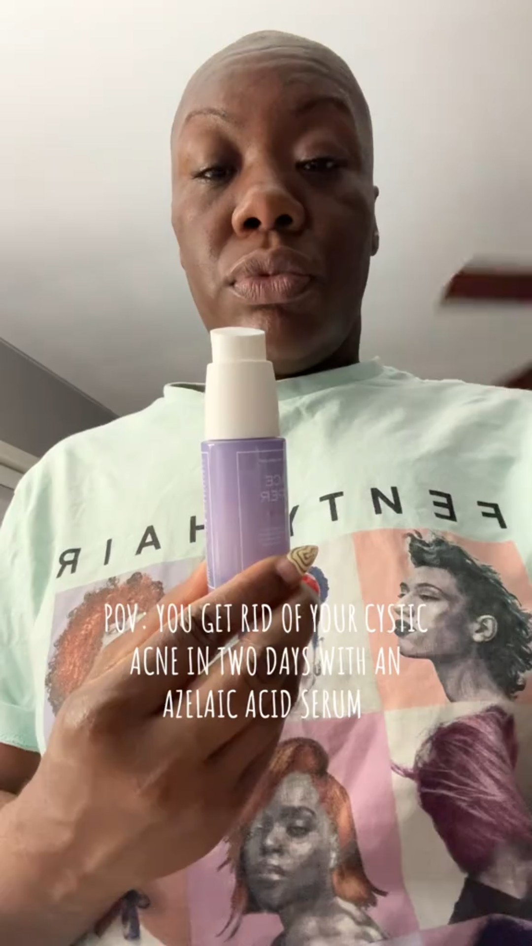 Banish cystic acne with the help of Sunday Riley. #acne #acnetreatment #acneproducts

#LTKU #LTKBeauty #LTKFindsUnder100