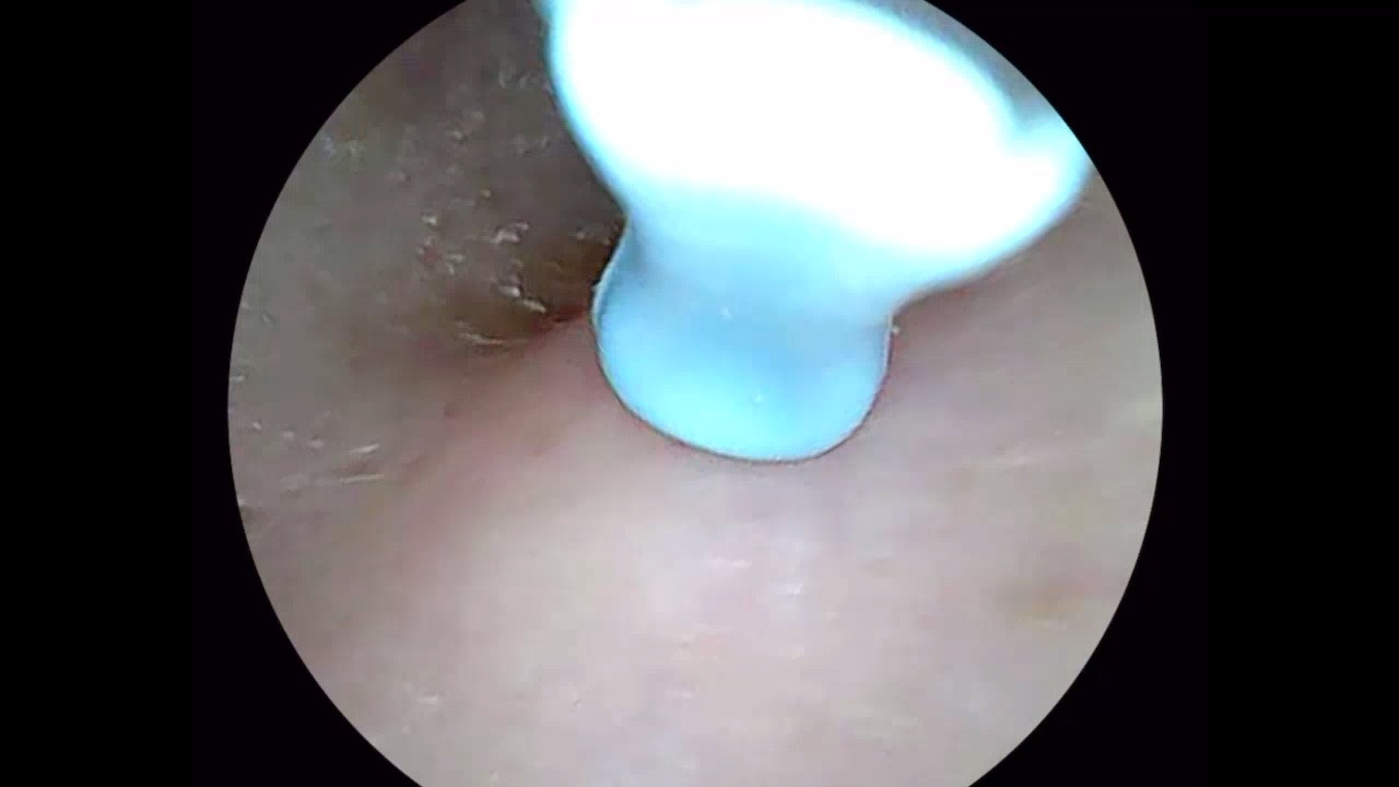 I tested the BeBird Earwax Removal Tool on my mom, who often struggles with earwax blockages, and the results were incredible. With the built-in camera, I could clearly see inside her ear and safely remove a wax plug the size of a cherry pit. She felt instant relief, and I felt confident knowing I wasn’t guessing like with cotton swabs.
This smart ear cleaner is not only a health and cleanliness essential, but it also fits right into a modern beauty and self-care routine. Easy to use, rechargeable, and effective—it’s the kind of personal care gadget that makes at-home grooming feel professional. 

 #LTKHome #LTKFindsUnder50 #LTKFamily