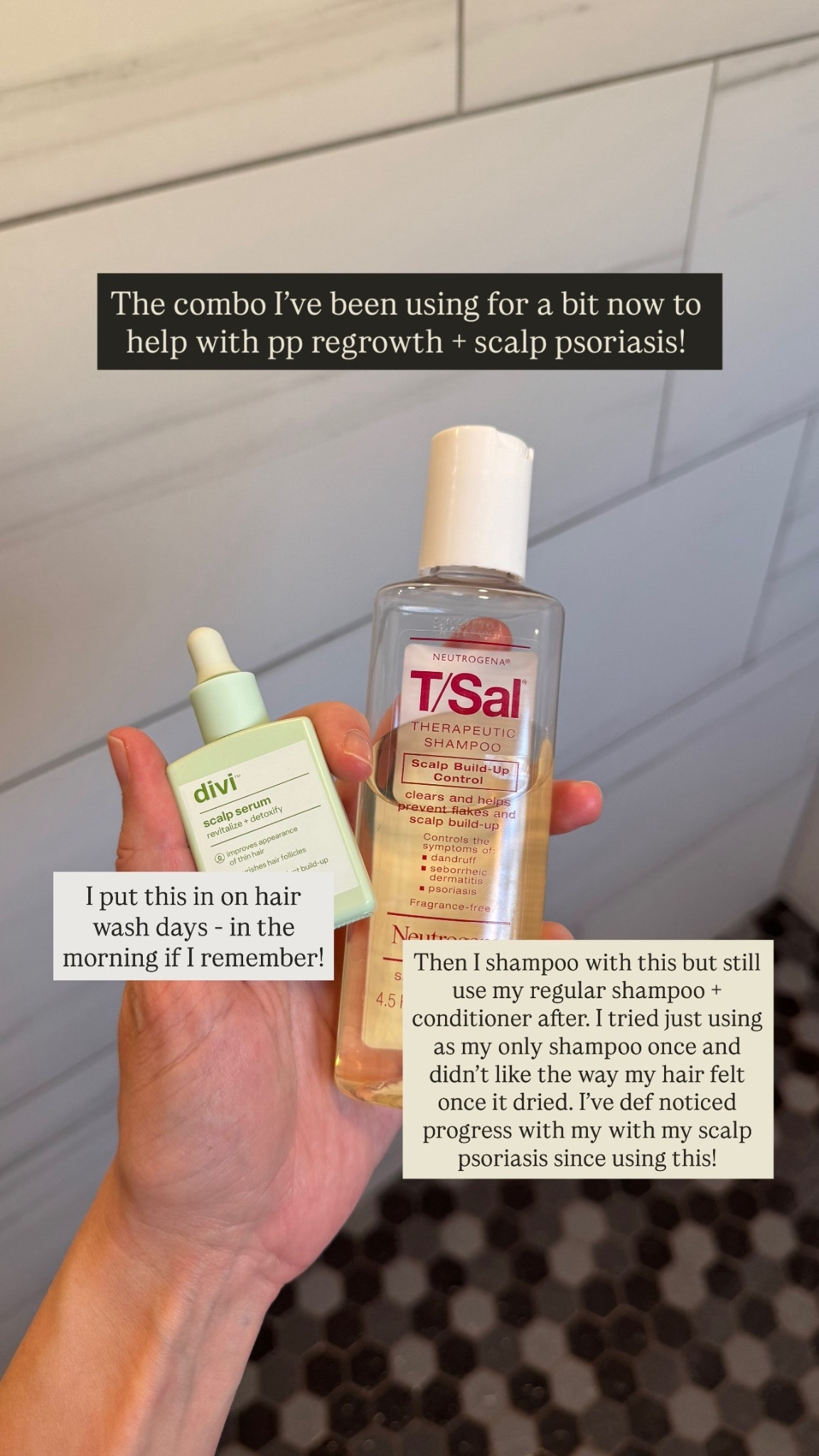 If you’re dealing with postpartum hair loss or scalp psoriasis, this combo has been a lifesaver. It helps soothe irritation, reduce flakes, and encourage healthy regrowth—all while keeping my hair soft and shiny again.