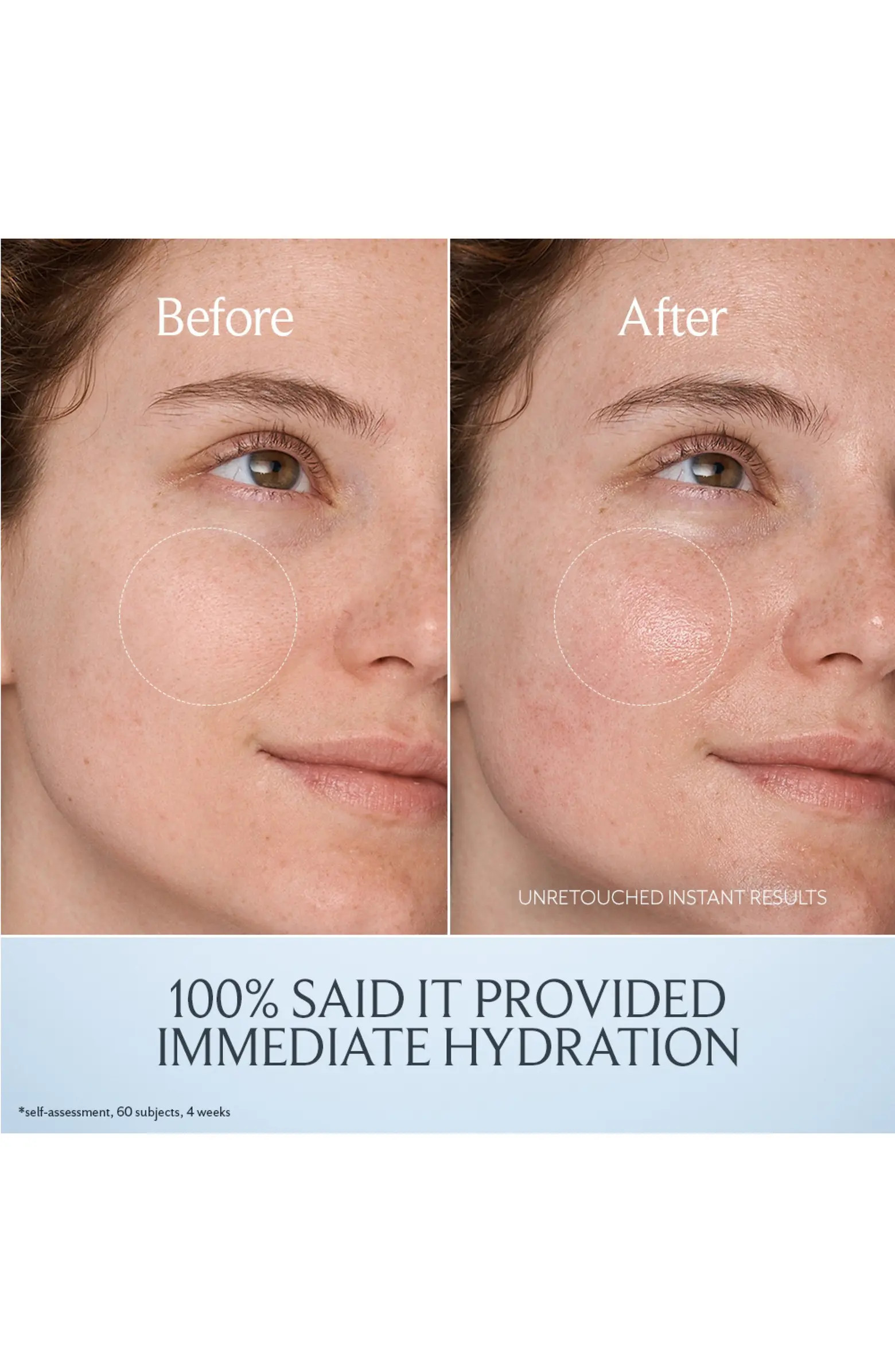 Kombucha Antioxidant Facial Treatment Essence | Nordstrom