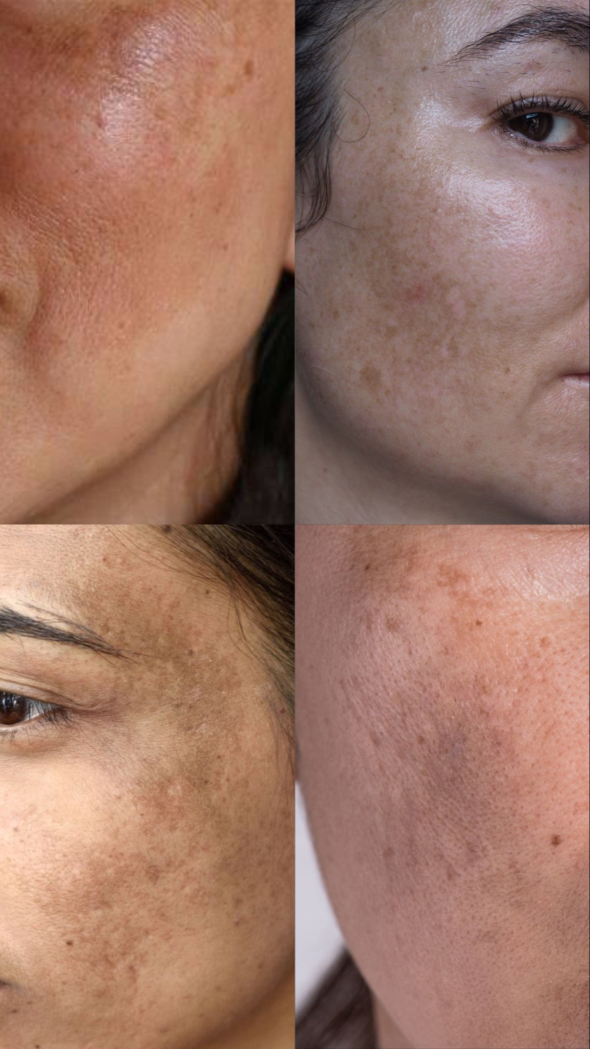 Produtos que indico para melasma.

#LTKbeauty