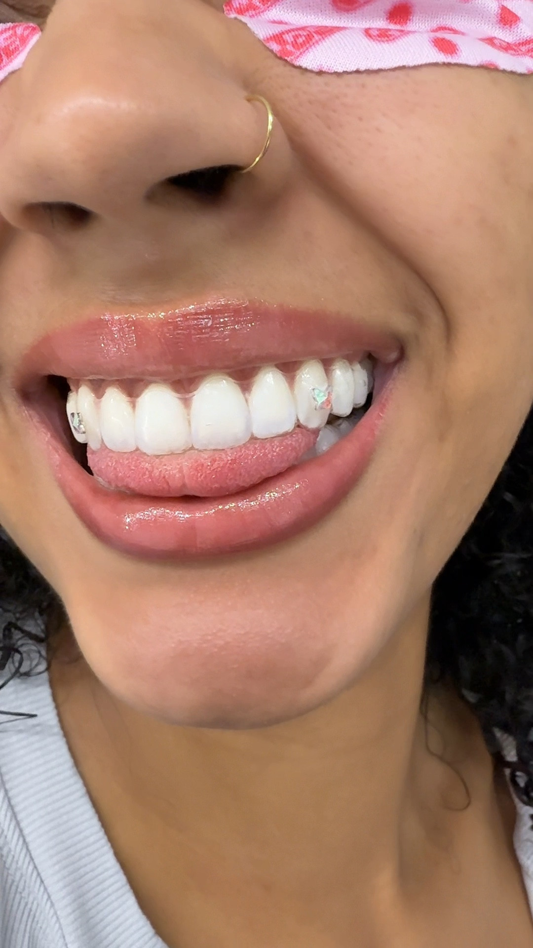 Tooth gems on my aligners so I can switch designs and be natural all at the same time 

#LTKU #LTKFindsUnder50 #LTKBeauty