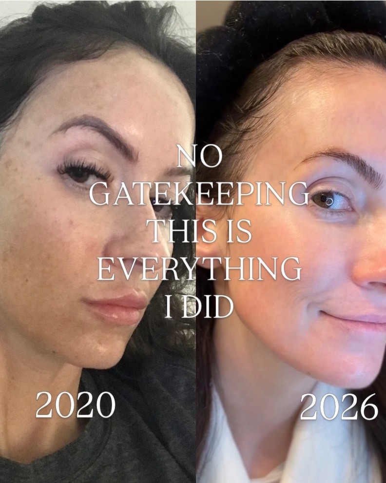 No gatekeeping - just the products I used on my skincare journey. 

#LTKOver40 #LTKBeauty #LTKselfcare