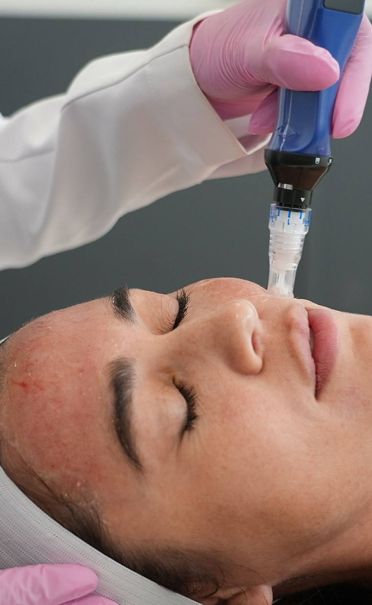 SkinPen® Microneedling | LaserAway