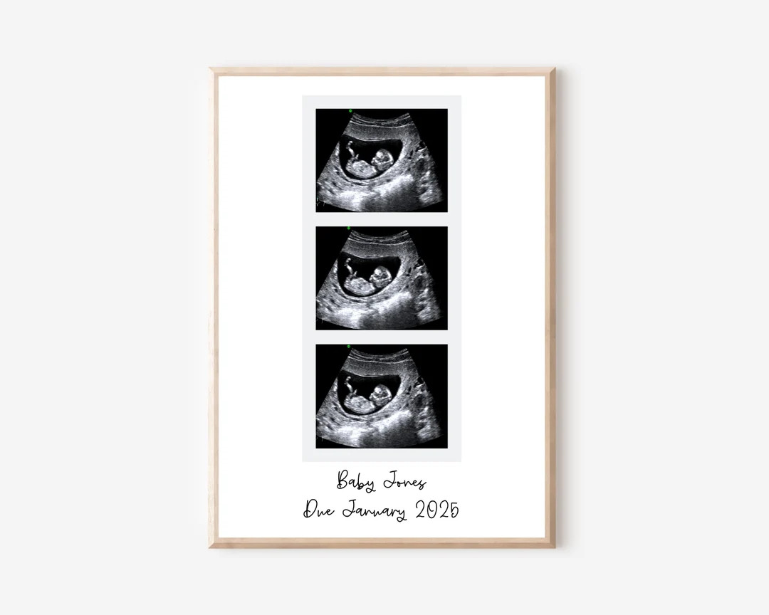 Personalised Ultrasound Strip Photo Strip Scan Photo Booth Sonograph Ultrasound Keepsake Baby Sho... | Etsy (US)