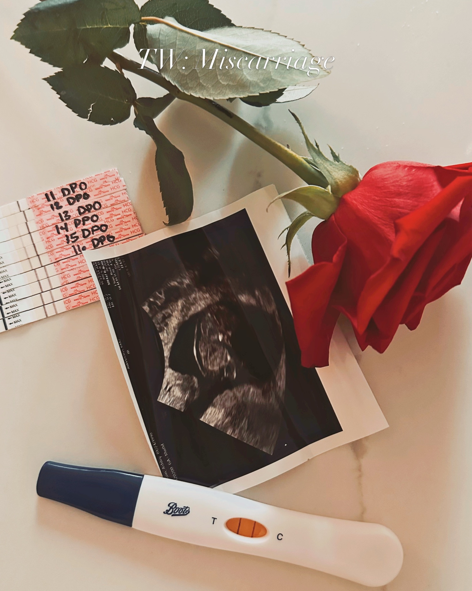 TW: Missed Miscarriage 

Just 3 days before starting a second IVF cycle to grow our family, we were shocked to see our very first spontaneous positive pregnancy test. And for 2.5 months, we got to secretly love on our little strawberry with so much excitement and disbelief! We began planning and scheming how our lives were about to change. How Rome would be as a big brother, what house projects we would need to finish & which pregnancy items to pull out of storage. 

But at our 10 week scan, we learned we were having a Missed Miscarriage. “We’re sorry, there is no longer a heartbeat” rang through the room. It is a blunt kind of heartbreak that has reshaped us from the inside out.

A missed miscarriage carries a very specific pain: where your body holds onto a pregnancy for weeks, sometimes months, after it has ended. Your symptoms are all still there, your baby still nestled in place, and your tummy still bloated. It leaves you stranded in an invisible pain while the rest of the world carries on around you. It is a quiet purgatory where you are forced to carry the daily reminders of what is no longer coming your way.

This journey has had days of immense gratitude followed by days of unbearable sadness. But in the darkest moments, the peace I’ve clung to most has come from women & friends of mine who have opened up about their own losses. Reading those countless stories has reminded me of a truth that is so hard to offer ourselves: they did nothing wrong to deserve their heartbreak, and neither did I.

Unfortunately there is no neat bow to wrap around this kind of loss—no easy answers or tidy endings. If this is your journey as well, I see you and hold your grief alongside mine. 

To our sweet little strawberry: you were loved from the very first second, and you have changed our hearts forever 🍓✨🪽 

#mmc #griefandloss #pregnancyloss

#LTKdayinmylife #LTKBump