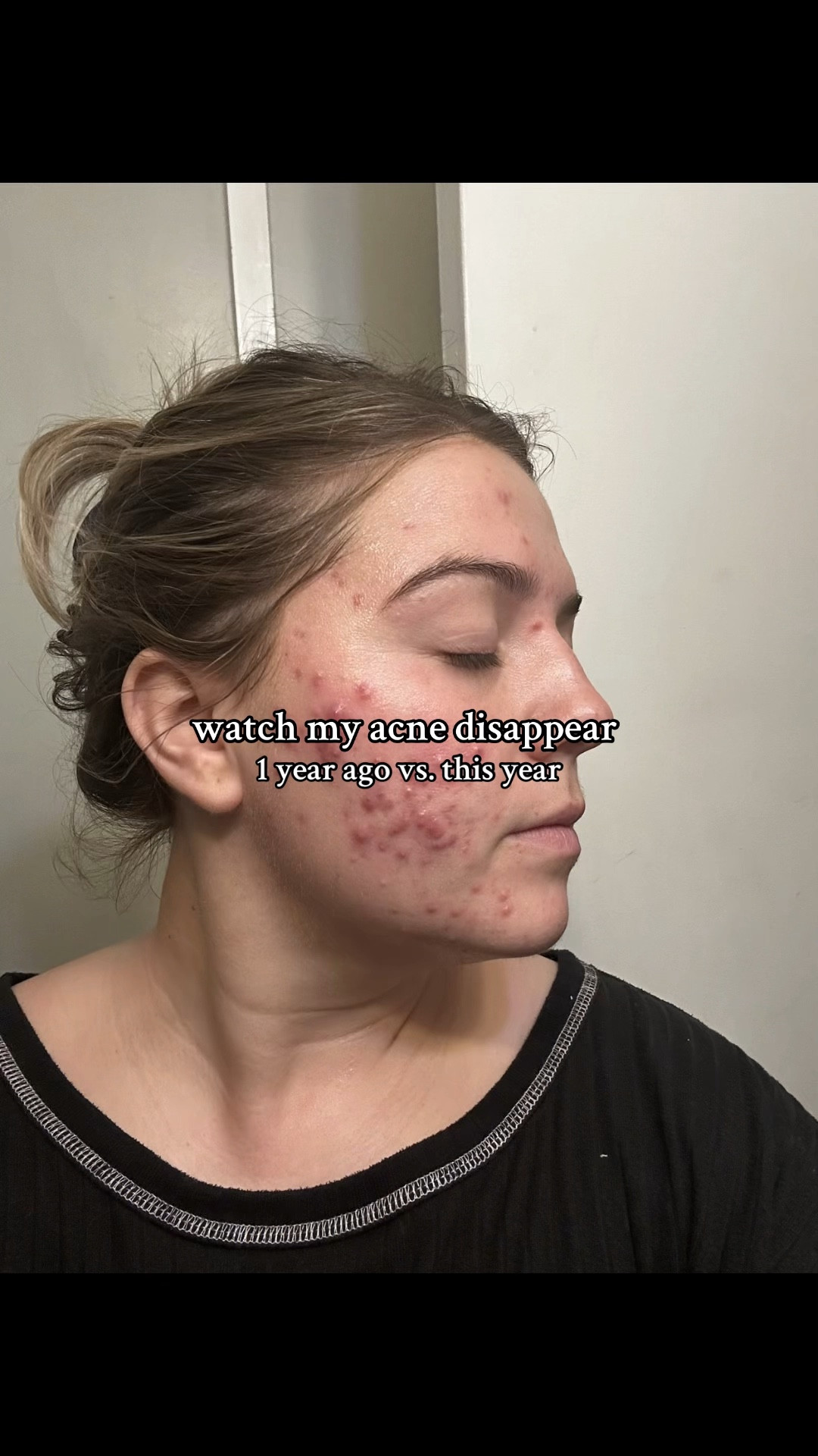 @clearstem changed the game for me 

#LTKFindsUnder100 #LTKBeauty