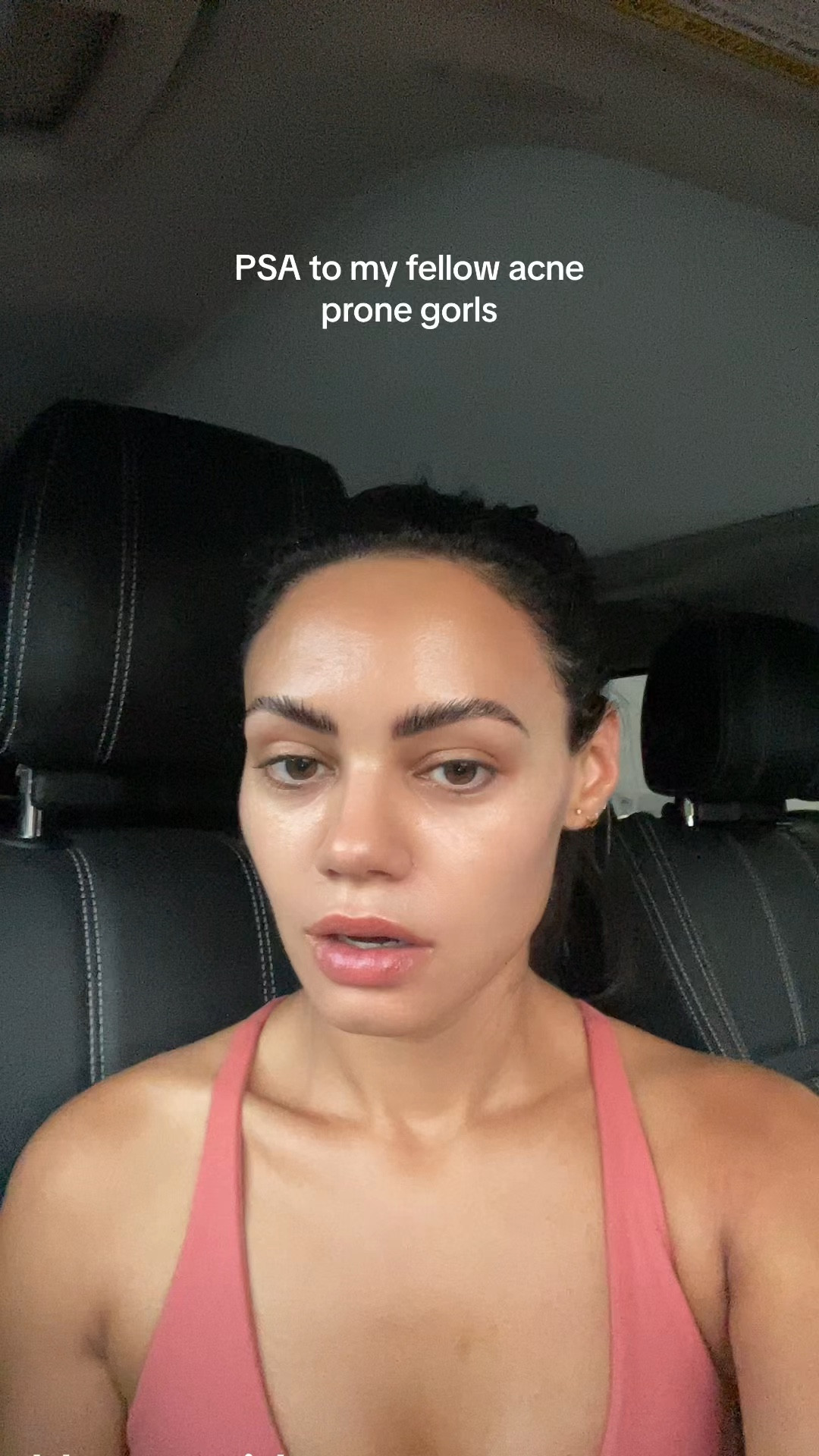 one of my best acne tips! hypochlorus acid spray has helped my skin so much and is a staple on my skincare routine now  

#LTKfindsunder50 #LTKbeauty #LTKVideo