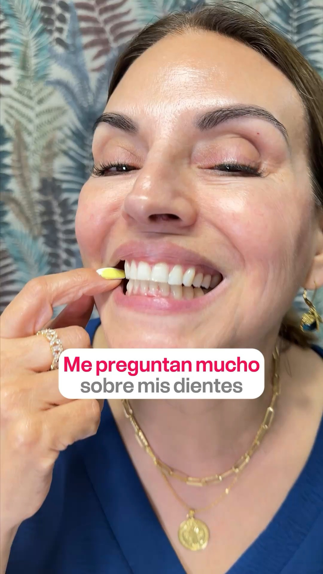 Me preguntan mucho sobre mis dientes

#LTKselfcare #LTKOver40 #LTKBeauty