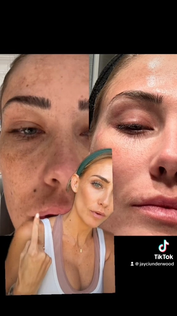 Skin cycling with the right products will change your life! Dr. Whitney Bowe is the genius behind the cycling. I do this NIGHTLY! 

1. Exfoliant 
2. Retinol
3. Moisturize 
4. Moisturize 

#skincare #melasma #skin #sundamage #grwm

#LTKFind #LTKbeauty