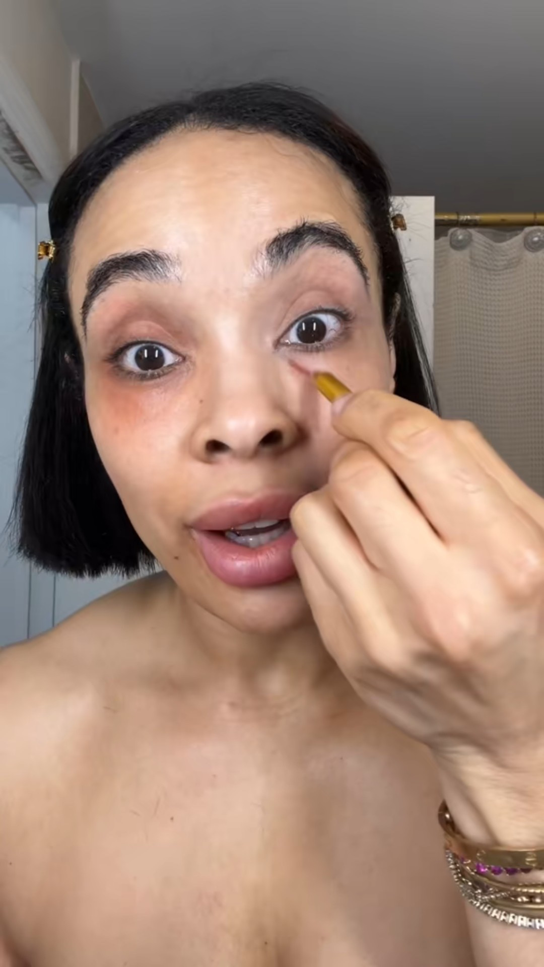 Dark circles gone!

#LTKBeauty