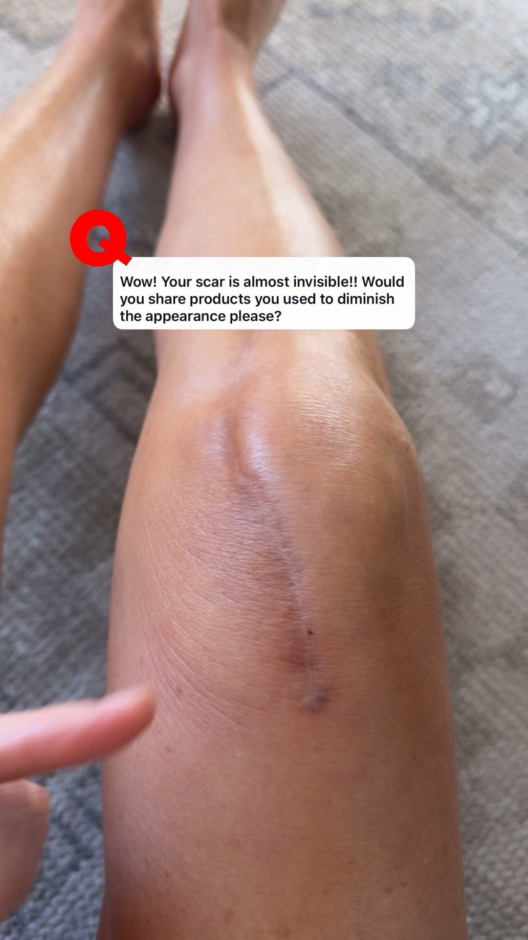 Osea daily! Improves skins elasticity
Vitamin E oil for the ultimate skin protection
Scar sheets to protect scar from sunlight (skin is extra sensitive)


#LTKOver40