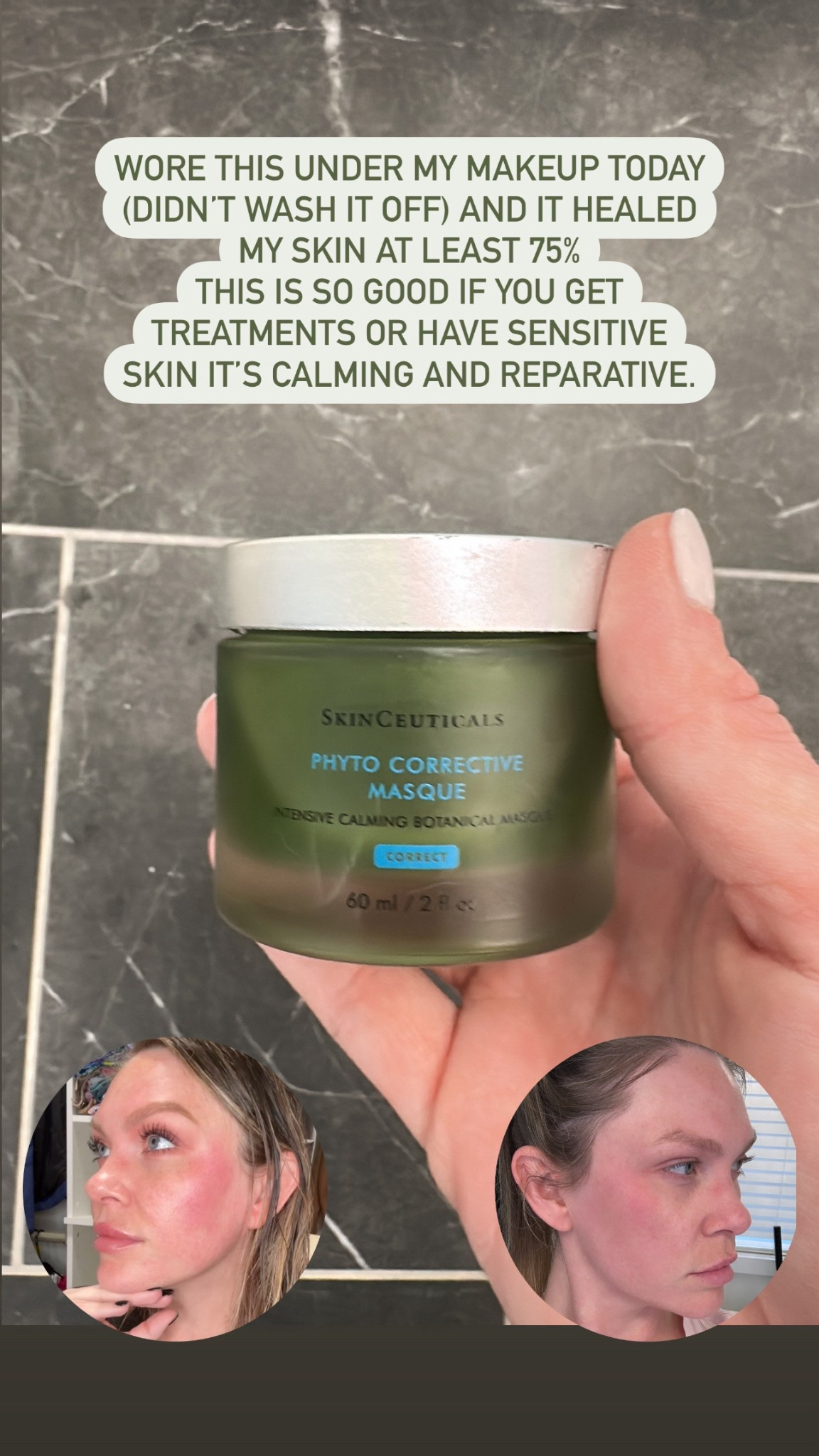I overdid my skincare and my sensitive skin paid the price! Ouch! But this phyto corrective masque came in handy. I put it on and didn’t wash it off and wore it all day under makeup. Tonight, my face is around 75% better! One more soak in this and I’ll be good as new! This is great if you get treatments or have sensitive skin! #skincare

#LTKBeauty #LTKFindsUnder100