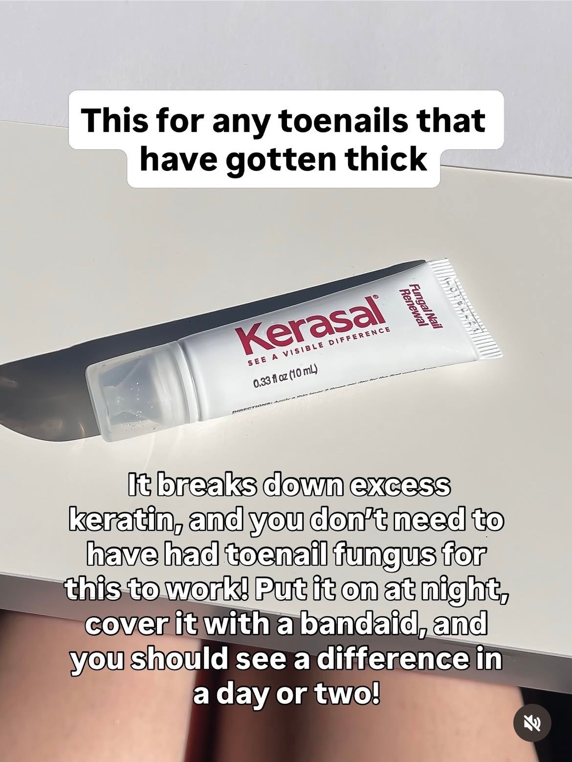 This stuff works to break down excess keratin on your toenails, you don’t need to have had a fungal issue for it to work!