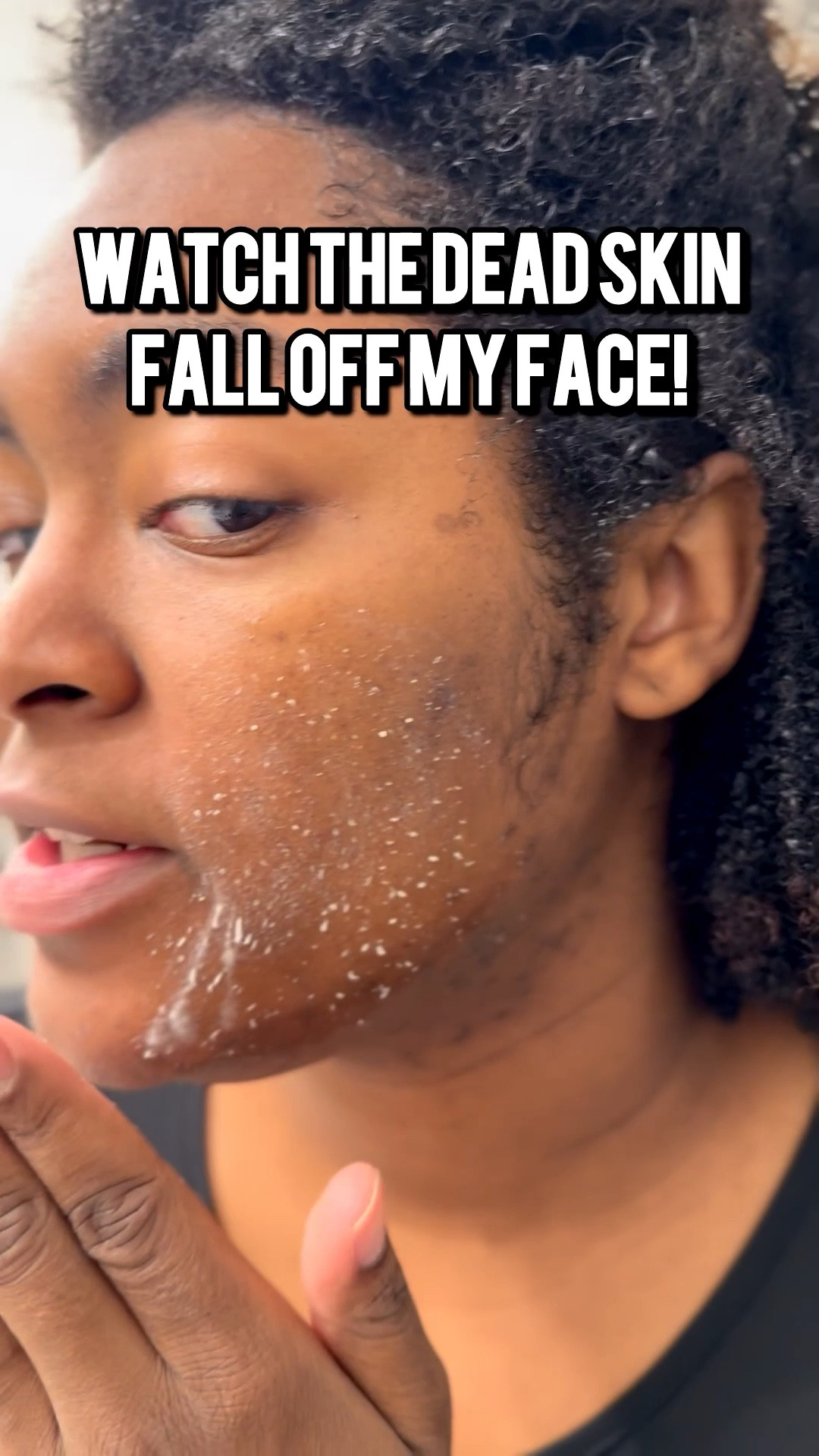 I can’t believe I had that much dead skin on my face. Thank you Sonia Roselli for sending me your Sexapeel Peeling Gel and Spray. Exfoliating is key to clear skin and these products literally pull the dead skin right off. 

#LTKBeauty #LTKgrwm #LTKselfcare