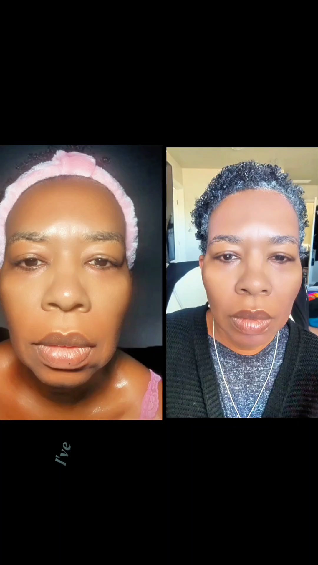 At 55, my esthetician reminded me that sagging, not wrinkles, should be my main concern—especially in my lower cheeks and neck and after using Murad Retinal ReSculpt Overnight Cream for over a month, I am seeing REAL results!  Knowing while I sleep it gets to work allows me to sleep pretty while wellness whispers into my skin. A nighttime must for me now. @muradskincare#muradskincare#muradpartner#retinal#AD#skincare

#LTKFindsUnder100 #LTKBeauty #LTKOver40