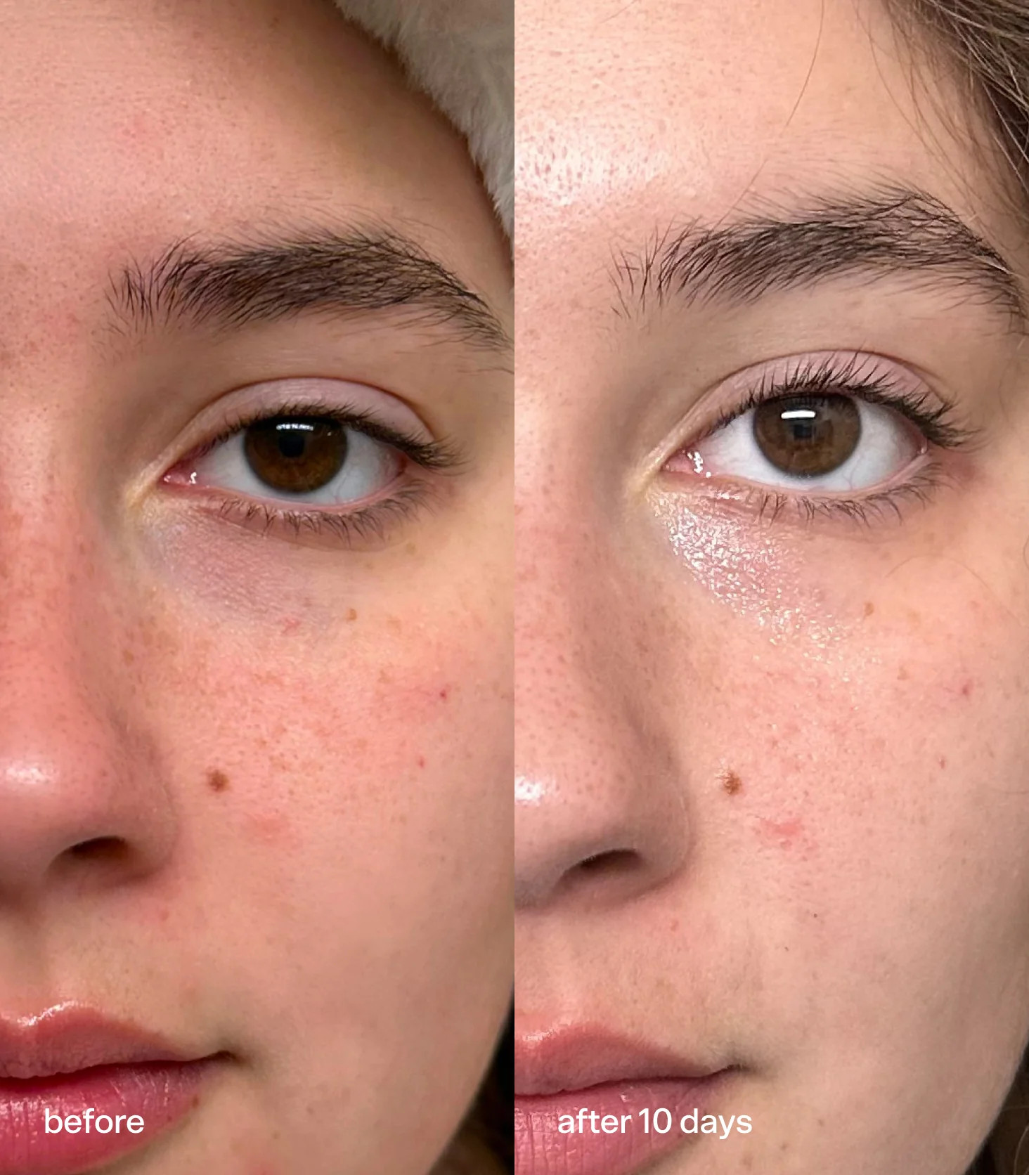 Star Dew | Bubble Skincare