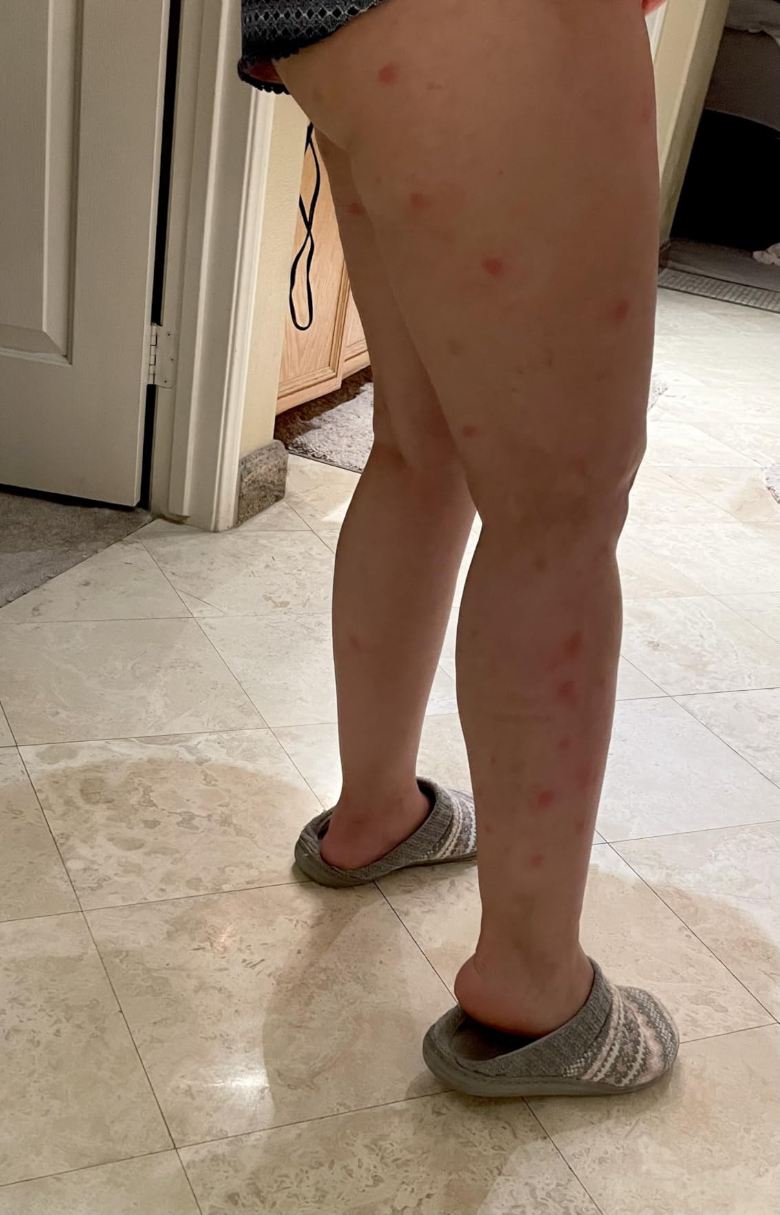 Quantum Health Buzz Away Extreme - DEET-free Insect Repellent, Essential Oil Bug Spray - Small Ch... | Amazon (US)