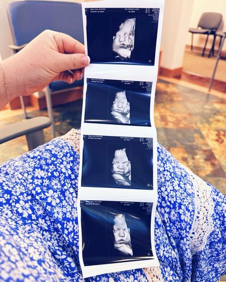 Look who we got to see this morning… hi my whittle angel baby!!! 🥹👶🏼😭 I can’t wait to snuggle those chunky cheeks 🥰 and kiss this whittle lips!! 😘 I love a good fully baked baby 🤭 and am getting SO excited to meet this sweet healthy baby boy!!! 👶🏼🩵🥳 #40weekspregnant 

Such a sweet surprise gift 🎁 getting to see Sweet Baby Levi Rhett at our 40-Week appt today (since I haven’t seen him since my 20-week anatomy scan - it’s truly been such a beautiful, joyful, and easy pregnancy 🙏🏽🙌🏽)!! 🫶🏽 The doctor said he’s still measuring perfectly and everything looks great!! 😍 We can’t wait to see when God decides “it’s time” for you to come meet us!!🤰🤱 #40weekultrasound #sospecial 

And goodness, your big brother Judson cannot WAIT to meet you!!! 👶🏼🩵👶🏼 He wanted to “say hi” to you and give you “kisses” 😚 as soon as mama came home with your ultrasound picture 🫶🏽 - and let’s just say I was an absolute puddle!! 🥹😭 Thank you, Jesus, for blessing me with these brother besties for life 🥰 and the amazing gift of being their mama!!!🤰✨🤱

Happy happy due date, my sweet baby boy!!🤰👶🏼🩵 Excited to see when God says “it’s time” for you to come 🤱, but for now, truly savoring these final days 🥹 of this miracle of having you still snug and cozy 🥰 in my belly (my little #40weekspregnant watermelon 🍉 hehe 🤭) a little bit longer!!! 👶🏼🫶🏽 #happyduedate #cantwaittomeetyou #ingodsperfecttiming #ilovebeingpregnant 

PS. Swipe through ➡️ this post to see my collection of bump photos🤰📸 throughout this pregnancy - soooo neat to look back and see how my belly has grown right alongside baby!! 🥹👶🏼 Oh, how mama can’t wait to meet you, sweet baby boy!!! 🤱🩵 #bumpphotos

#LTKFamily #LTKBaby #LTKBump