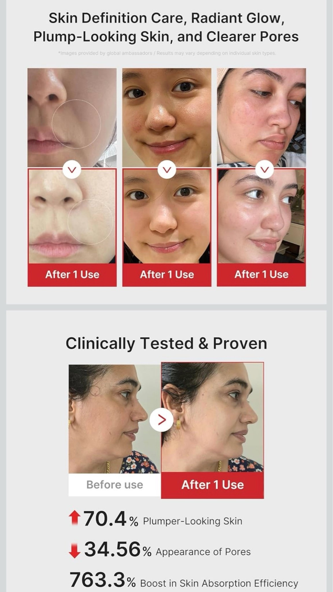 Mother’s Day gift idea that actually WORKS 😍✨
The viral Medicube Booster Pro + Salmon PDRN serum are everywhere right now and even Kylie Jenner uses them 🤍

Millions of reviews for a reason… glowing skin, firmer looking texture, better product absorption, and that glass skin effect everyone is chasing 💫

And right now it’s on a HUGE sale 👀 was $220 now only $150 which is over 30% off 🤯 limited time and 1000% worth it if you want real results

#Medicube #GlassSkin #KoreanSkincare #BeautyFinds #MothersDayGiftIdeas

#LTKxMadewell #LTKMothersDay #LTKdayinmylife
