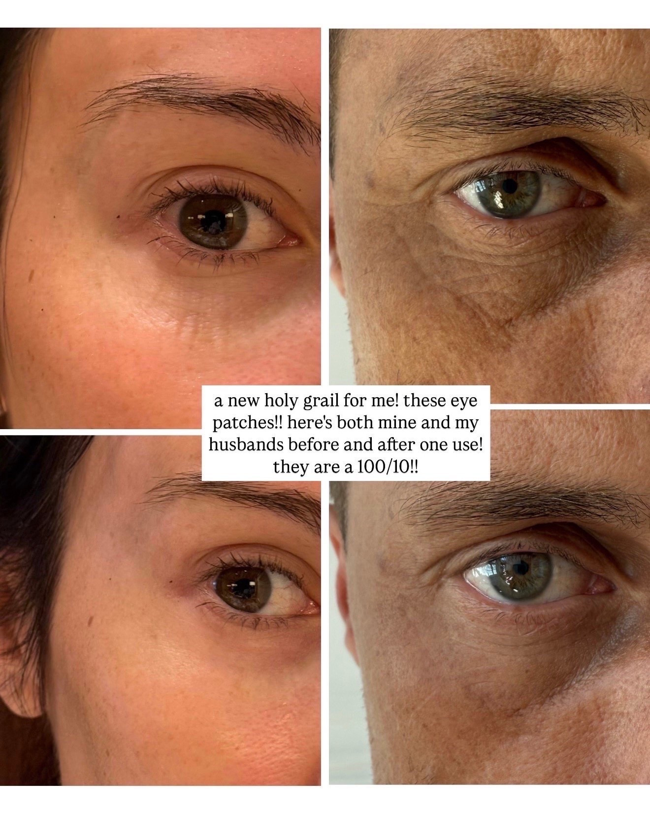 My holy grail eye patches!  These are the best - works amazing on my husband too!  

@summerfridays  over 40 skincare, skincare routine

#LTKOver40 #LTKBeauty #LTKmorningroutine