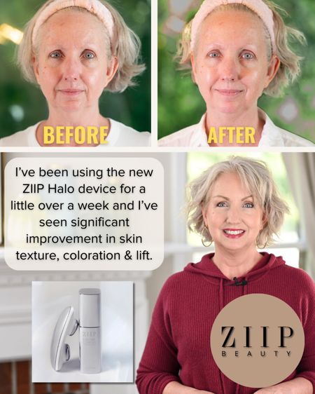 I'll let you in on a little secret. I've been using the ZIIP Halo for a little over a week and I'm seeing noticeable improvement in my skin already. @ziipbeauty #sponsored This device is so easy to use; it takes just 4 minutes every few days to see significant improvement in skin tone and tightness. I've noticed reduced wrinkles, lift throughout my face, more contouring, more even skin texture and coloration, and a significant reduction in puffiness in my jowls. Ooh! I hate that word. Hahaha! But the results I'm getting with ZIIP Halo is no joke. Use code ZIIPKAY for 15% off ZIIP HALO and all gels through 9/30, then 10% thereafter. 

#LTKsalealert #LTKover40 #LTKbeauty
