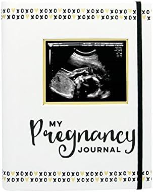 Pearhead My Pregnancy Journal, Pregnancy Book, Capture Every Precious Moment of Your Pregnancy, G... | Amazon (US)