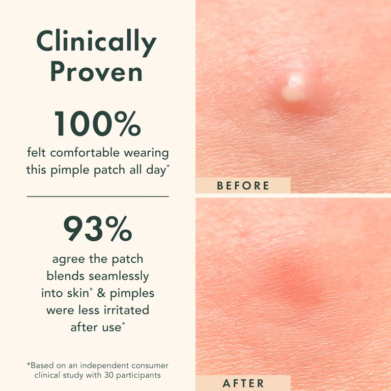 Rael Beauty Miracle Acne Patch Invisible Spot Cover, for All Skin Types, 24 Count | Walmart (US)