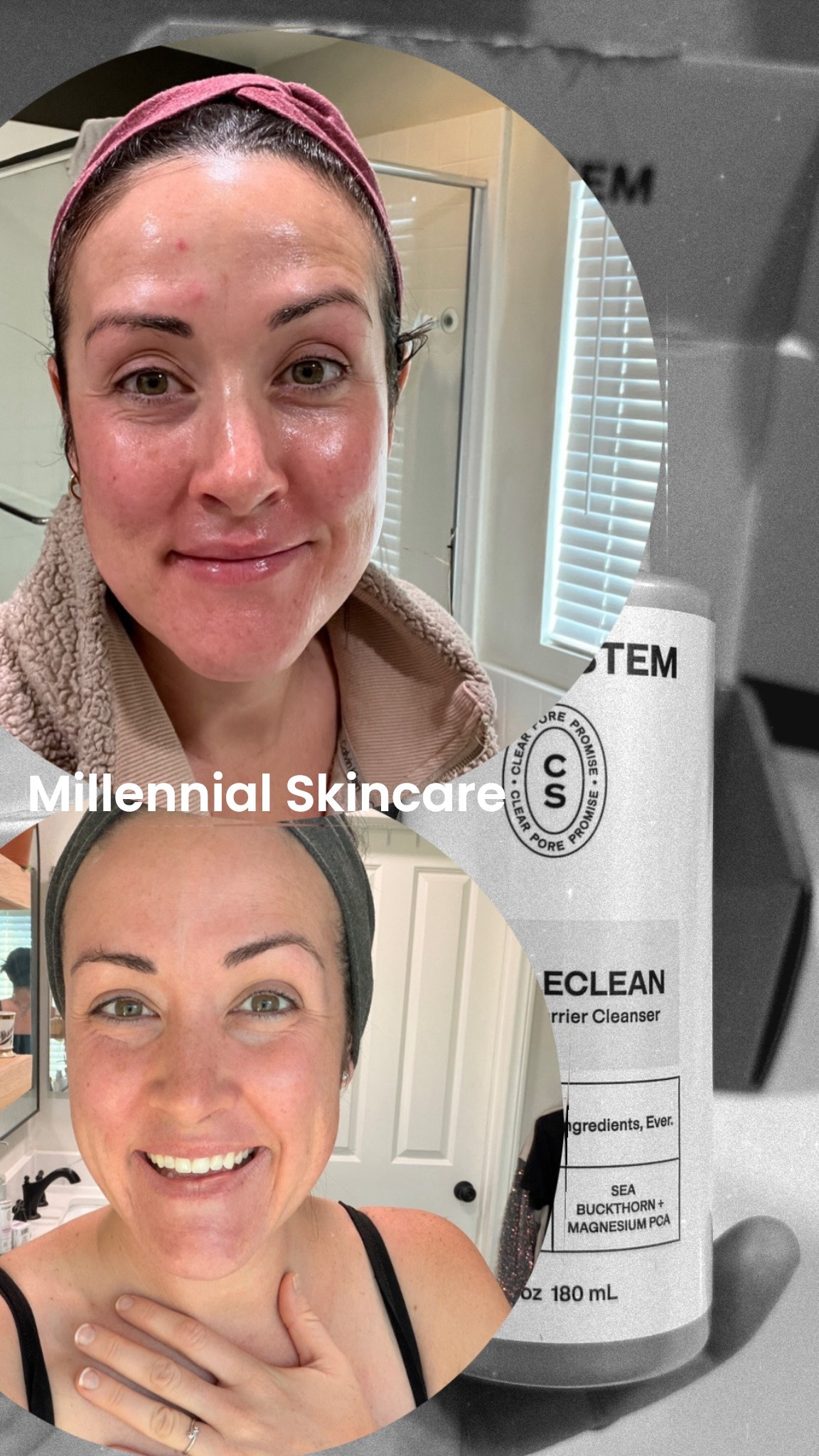 Aging, dry + breakout prone skin as a millennial. Clearstem has the best skincare products, especially if you’re a mom with breakout prone skin. 

Code ANNA_P for 15% off

It has been the only thing to remove the tiny blackhead bumps around my mouth and treat breakouts without over drying my skin  

#LTKmorningroutine #LTKmomlife