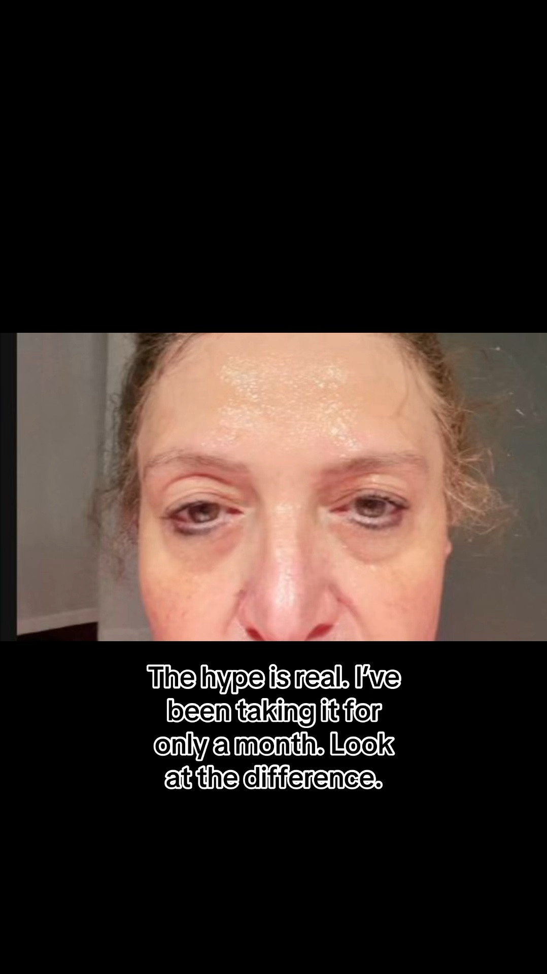 This is how taking Catakor NAD + supplement for 1 month .  Rejuvenated. My skin .  I take it daily now . These are real results no filter.  

#LTKOver40 #LTKBeauty #LTKdayinmylife