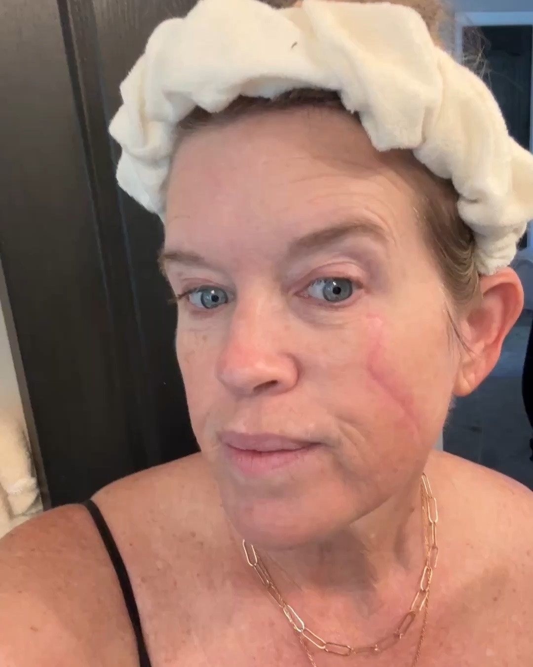 Self-care day

Melanoma Cancer Journey 
10days after 3rd laser treatment 

Products  I am using today

Listing in order of use:

Borge- Xlg face towels larger & thicker
💯 biodegradable, so soft, chemical free

Elemis- Pro Collagen Green Fig cleansing Balm 

Thayers- hydrating milky mist
Oat milk and 7% glycerin 
Touchless 24 hour hydration, instantly dewy skin

Vit c serum 

Michael Todd sonic smooth pro-Dermaplaning microdermabrasion  & Facial hair removal system with led light

Repeat with:
Thayers- hydrating milky mist

Coleen Rothschild- glycolic acid peel pads with blue agave

Cosrx- advanced snail mucin glass Glow Hydrogel Mask 
Snail secretion filtrate + collagen 
For glowing skin, hydration and soothing plus firming 
Goes on white and you wear until transparent 

Use jade roller over mask to help press moisture into face & plus it’s soothing 

Remove mask and let skin breathe for about 5 mins 

Radiance Project by Mirabella LED Facial Mask with infrared 
-Fine Lines & Wrinkles
Blemishes 
Uneven skin tone
7 light treatment choices 
Pamper skin without downtime rechargeable 7-15 min depending on light color

Finishing up with

One skin 
08-01 eye topical supplement-
Essential Eye cream
Around eye area

Then One skins 08-01 Face topical supplement essential moisturizer 

Dime - wonderscreen broad spectrum spf 30

Repeat Thayers - hydrating milky mist

#LTKselfcare #LTKOver40 #LTKBeauty