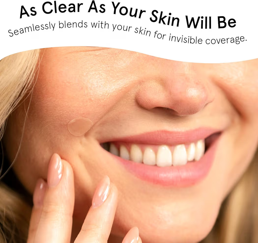 grace & stella Award Winning Pore Strip - Pimple Patches for Face - Hydrocolloid Acne Patches for... | Amazon (US)