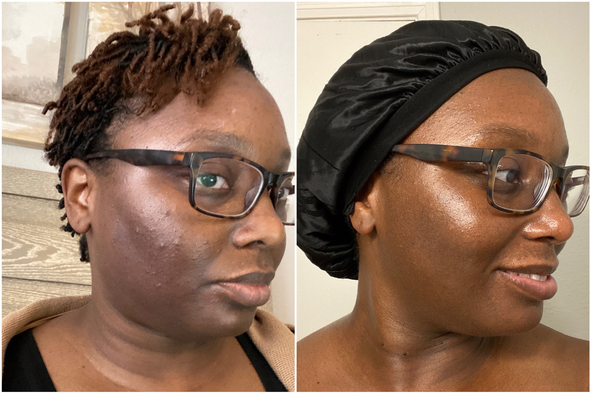 Skincare update! I’ve found the products that make me feel like a human again. 😂 Photos about a year apart. The only products not linked are the magic Face oil and the eye balm both by folk potions, and the biossance mineral sunscreen  