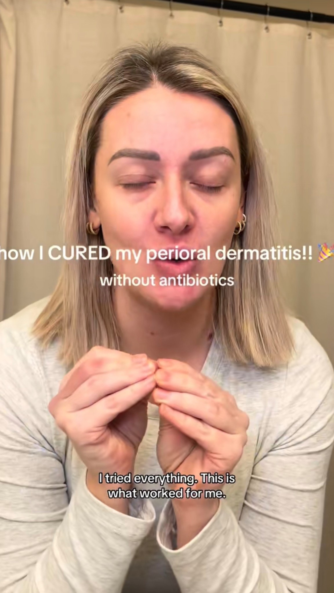 perioral dermatitis skincare routine! All pregnancy safe

#LTKmomlife #LTKgrwm #LTKselfcare
