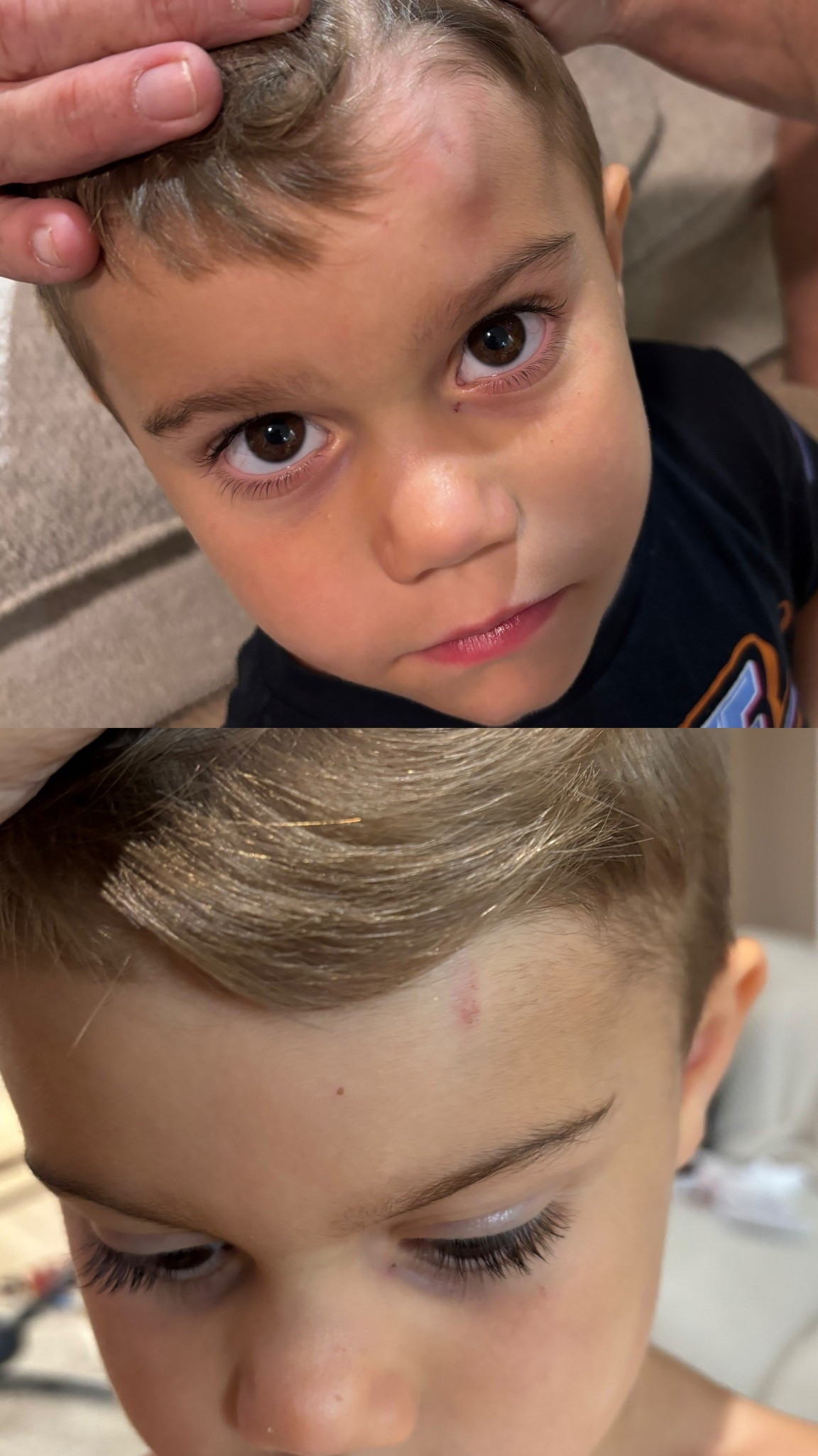 Every parent must have this in their medicine cabinet. This is less than 24 hours difference!!

#LTKKids #LTKBeauty #LTKFamily
