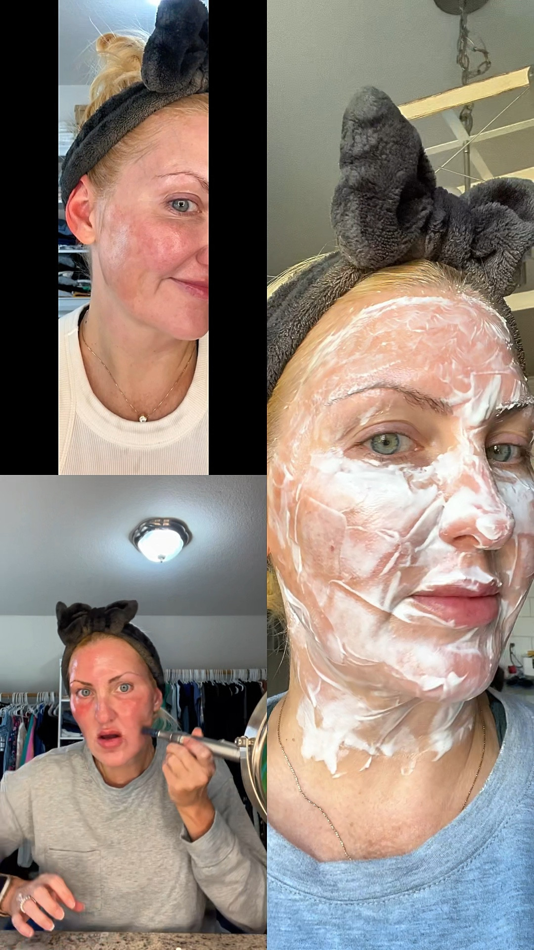 💆🏼‍♀️My new favorite DIY obsession💕
Micro-needling is something you can easily do at home to save 100s of dollars! Save that money for a laser treatment! 💰
💕Love my Dr. Pen M8S pen! 🖋️
✅ Improves skin tone, scarring, acne, sun spots, fine lines and wrinkles, and helps rebuild collagen! Slow the signs of aging with little to no downtime  

#LTKBeauty #LTKOver40