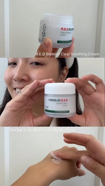 4 steps to anti-blemish & anti-redness skin!

I have been suffering skin redness and blemishes so much lately, I have to say the new R.E.D skincare range from @dr.g_official_global has been a game changer ! 

Being the No.1 Skincare Brand,  No. 1 Dermacosmetic Brand and the No.1 Facial Cream Brand in Korea, I love how this skincare routine address exfoliation, soothing, hydration and barrier repair in 4 simple steps, whilst minimising irritation for sensitive, redness-prone and blemish-prone skin.

product used:
- Dr. G Brightening Peeling Gel
- Dr. G R.E.D Blemish Clear Soothing Toner
- Dr. G R.E.D Blemish Clear Soothing Cream
- Dr. G R.E.D Blemish Clear Hyal Cica Soothing Serum

AD - kindly gifted

#koreanskincareroutine #skincareroutine #blemishes #antiagingskincare skincarelover

#LTKaustralia #LTKbeauty