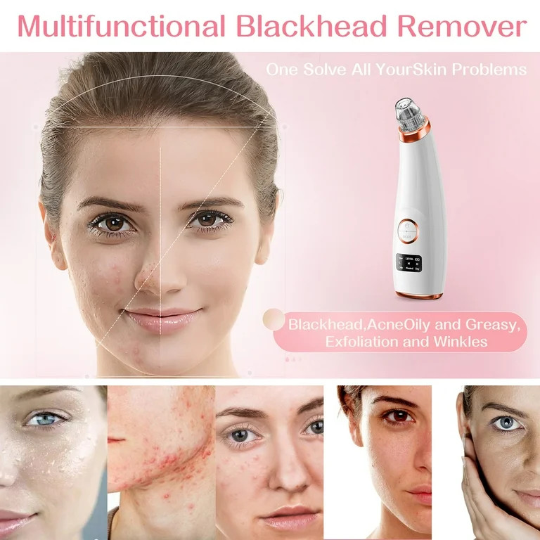 Blackhead Remover Pore Vacuum, w/ Hot Compress Function, Deep Facial Cleaner, Acne Comedone White... | Walmart (US)
