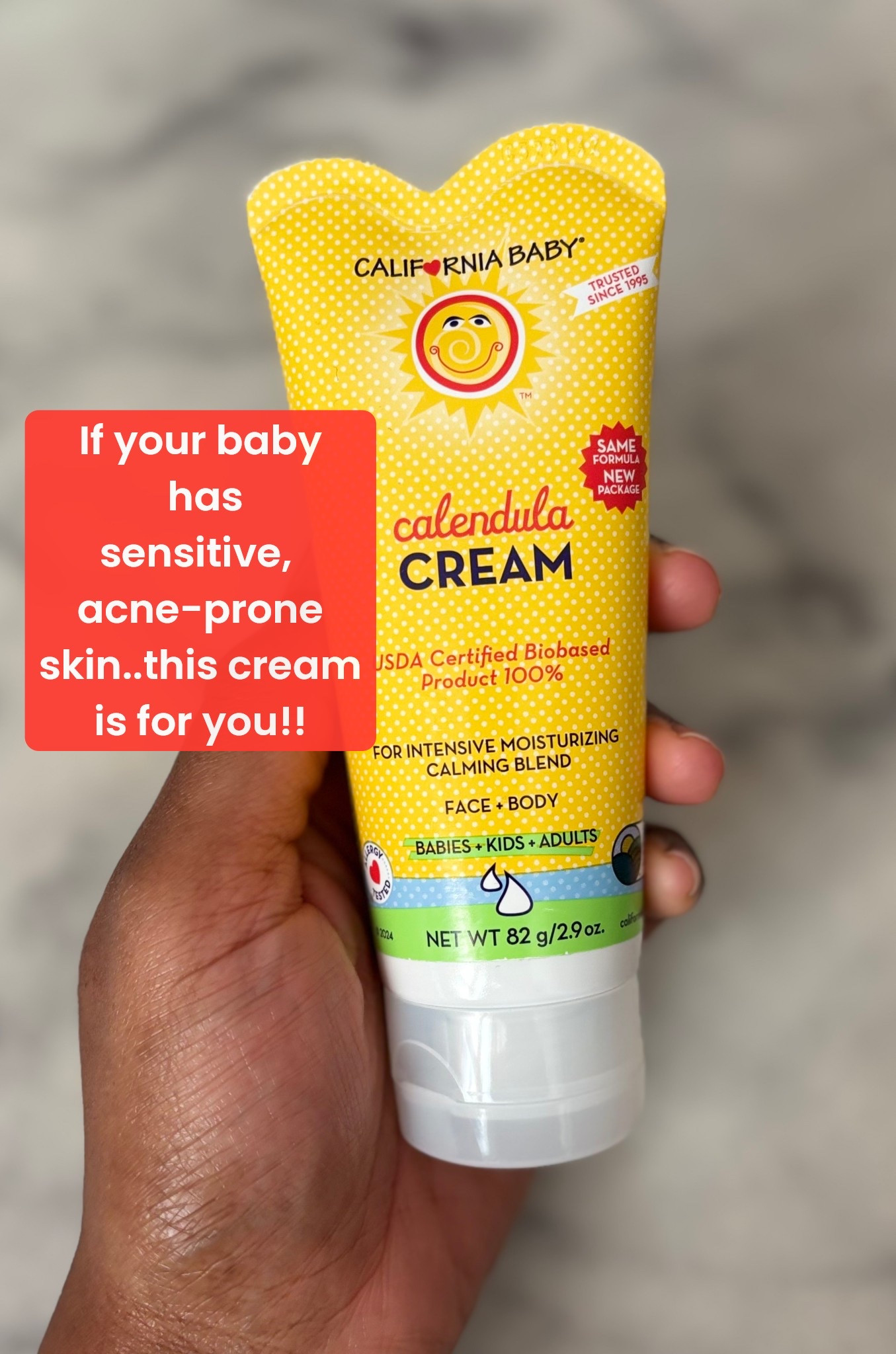The healing cream every mama needs in her diaper bag 🤎

If your baby has dry patches, diaper irritation, eczema-prone skin, or those random rough spots, this calendula cream is pure magic. It’s plant-based, super gentle, fragrance-free, and made with organic calendula to calm, soothe + protect sensitive baby skin.

We use it for face dryness, drool rash, diaper area, little scratches… literally everything. A little goes a long way!

Perfect for: newborns, sensitive skin babes, everyday moisture, moms who want clean + non-toxic skincare 🌱👶🏽

Keywords: California Baby Calendula Cream, baby skincare, clean baby products, nontoxic baby essentials, newborn must haves, eczema friendly, mom approved, baby lotion, gentle moisturizer, LTK baby finds, toddler skincare.

#LTKmomlife #LTKBaby #LTKKids